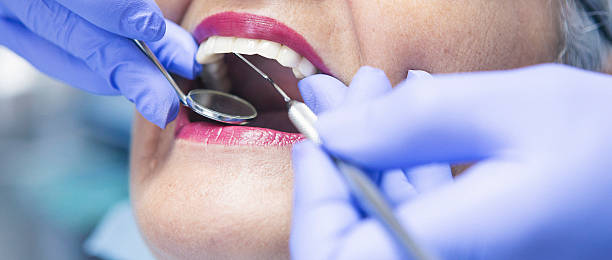Best Walk-In Emergency Dentist in Kennesaw State University, GA
